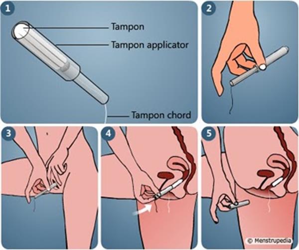 tampon (Copy)