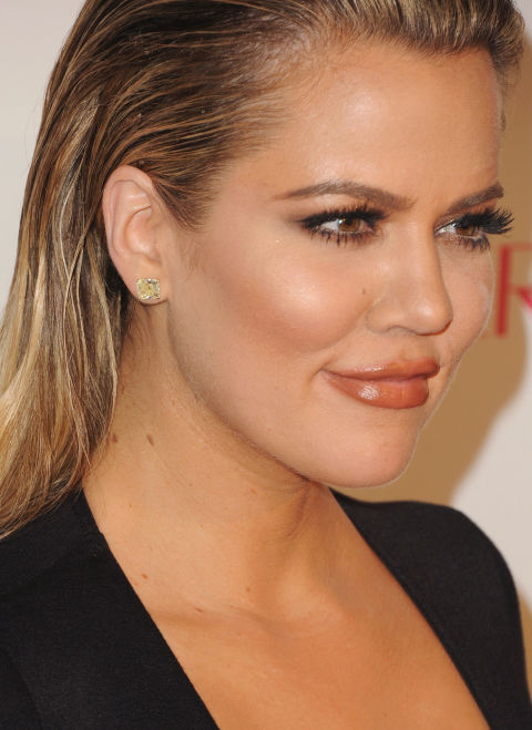 khloe-kardashian-moles